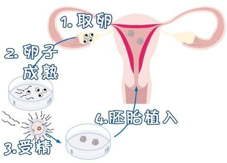 关于明远生殖医学中心